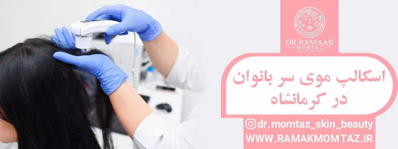 اسکالپ موی سر بانوان در کرمانشاه