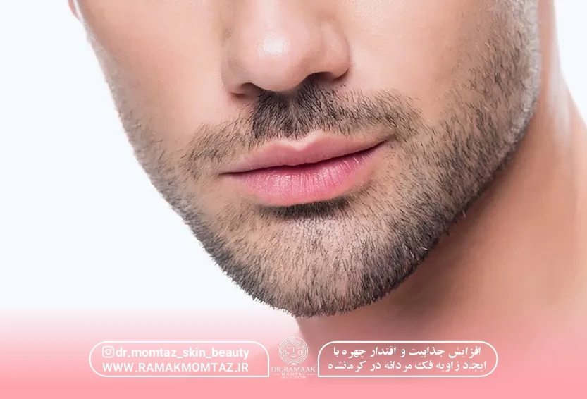 افزایش جذابیت و اقتدار چهره با ایجاد زاویه فک مردانه در کرمانشاه