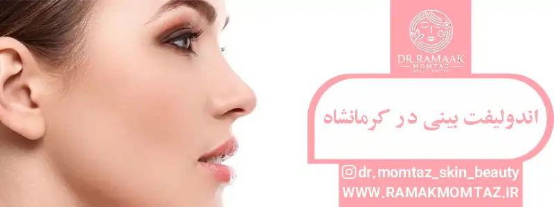اندولیفت بینی در کرمانشاه