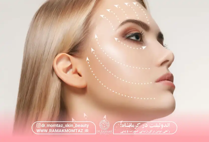 اندولیفت در کرمانشاه راهی نوین برای زیبایی صورت و بینی