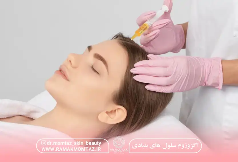 اگزوزوم سلول های بنیادی