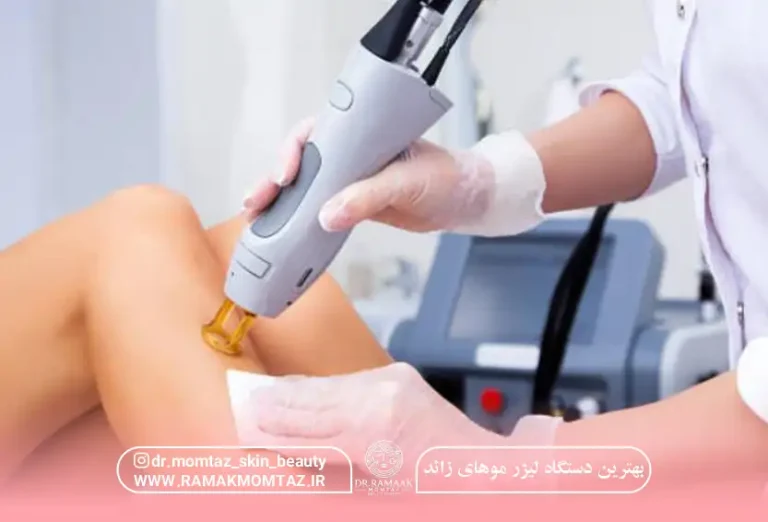 بهترین دستگاه لیزر موهای زائد کدام است؟ مقایسه انواع دستگاه ها