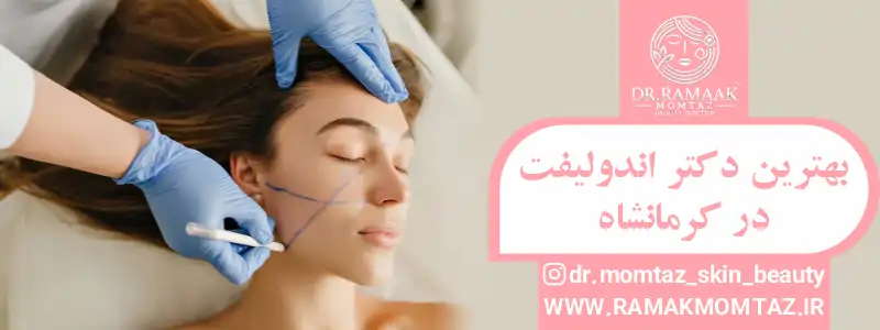 دکتر رامک ممتاز: بهترین دکتر اندولیفت در کرمانشاه