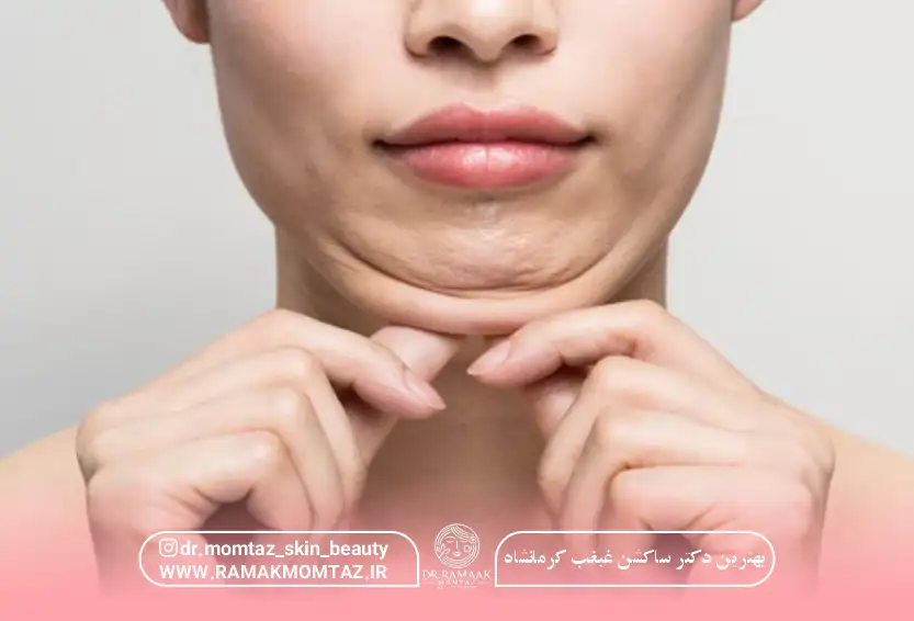 بهترین دکتر ساکشن غبغب کرمانشاه: راهنمای کامل + هزینه (1403)