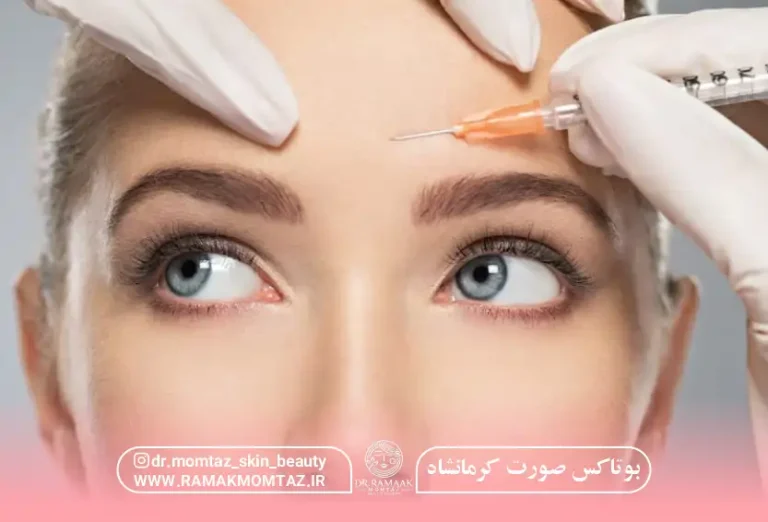 هزینه بوتاکس صورت در کرمانشاه + بوتاکس بینی، زیر بغل و چشم گربه ای (1403)