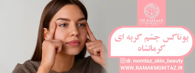 بوتاکس چشم گربه ای کرمانشاه (1)