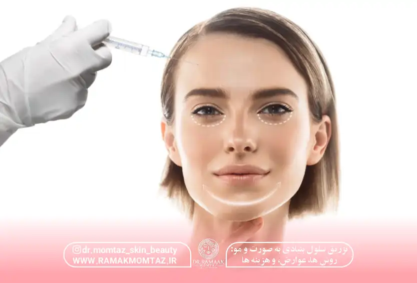 تزریق سلول بنیادی به صورت و مو: روش ها، عوارض و هزینه ها