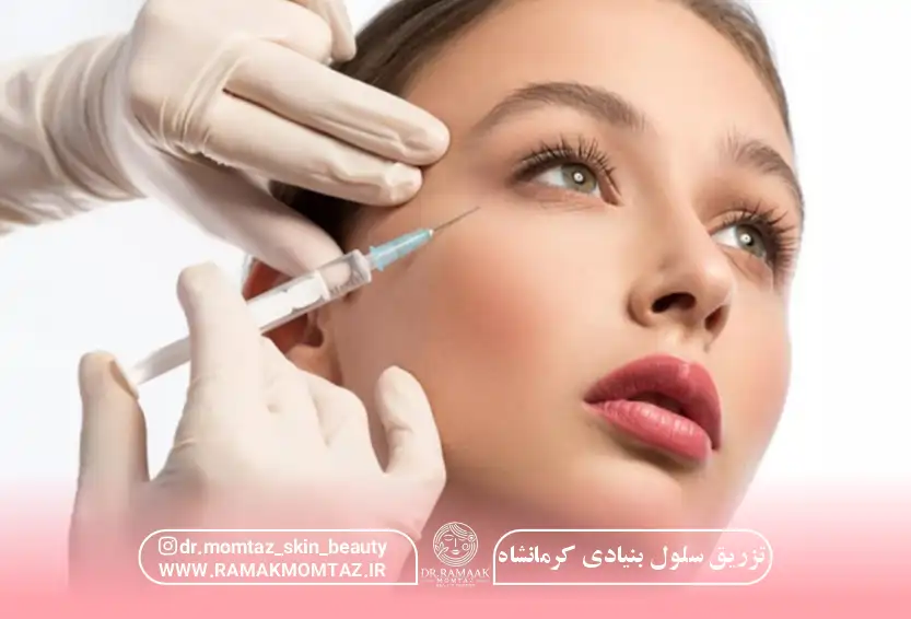 تزریق سلول بنیادی کرمانشاه