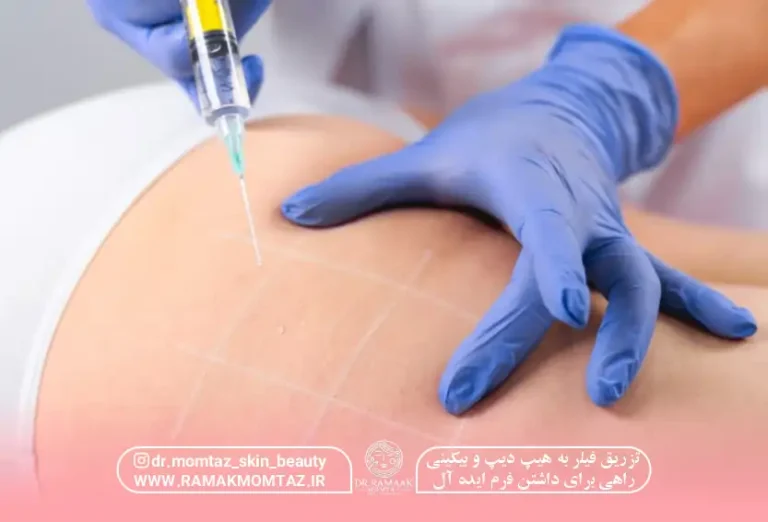 تزریق فیلر ب هیپ دیپ و بیکینی