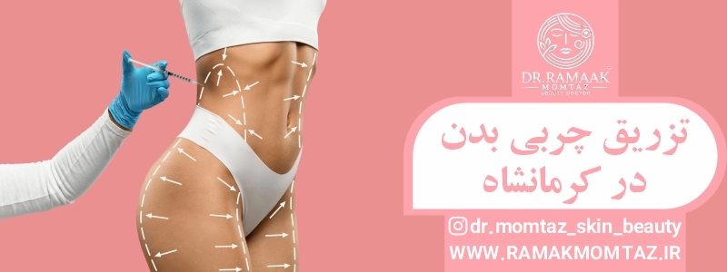 تزریق چربی بدن در کرمانشاه