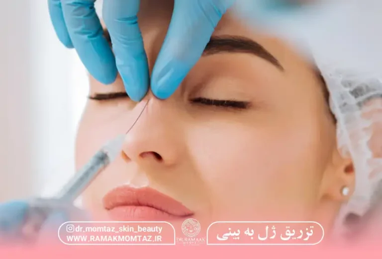 راهنمای جامع تزریق ژل به بینی کرمانشاه + هزینه 1404 و معرفی بهترین دکتر