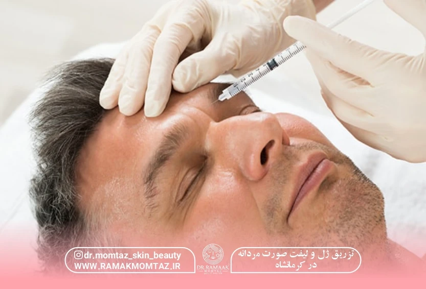تزریق ژل و لیفت صورت مردانه در کرمانشاه