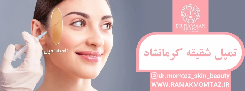 تمپل شقیقه کرمانشاه