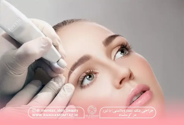 جراحی پلک با لیزر در کرمانشاه