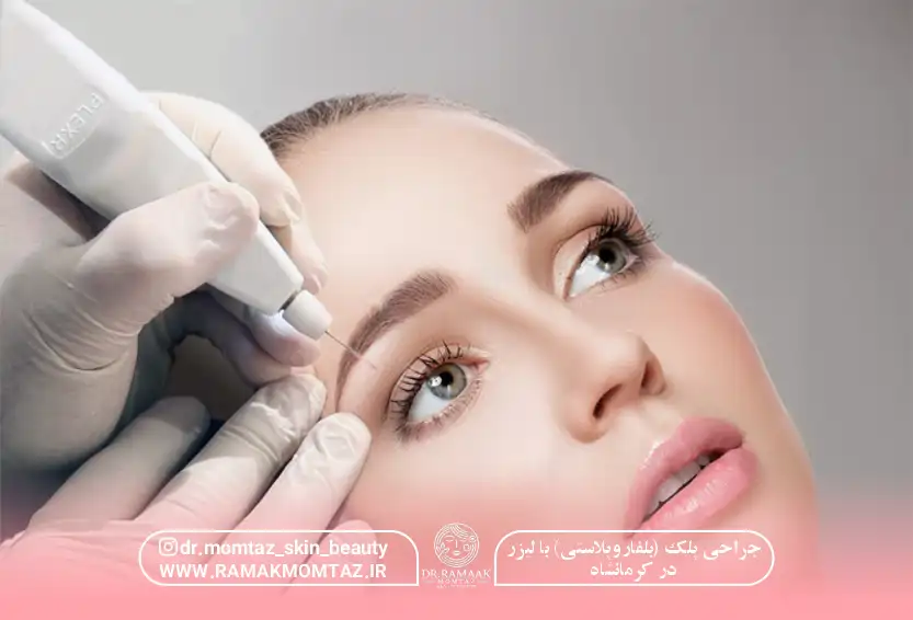 جراحی پلک با لیزر در کرمانشاه