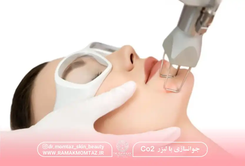 جوانسازی با لیزر CO2