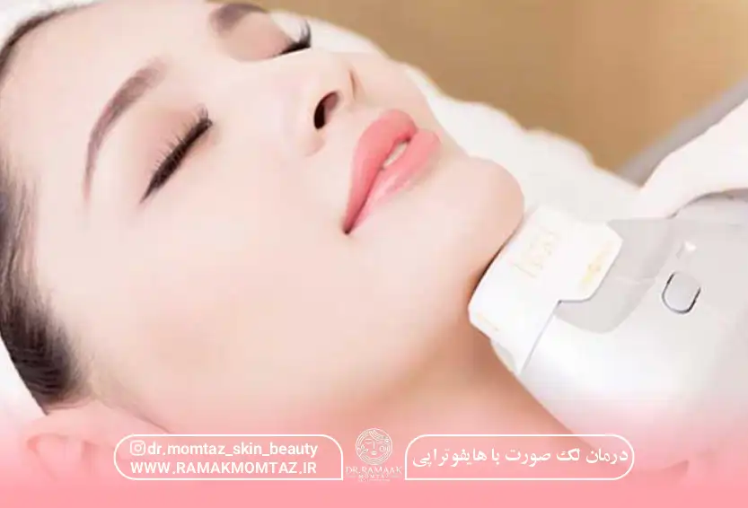 درمان لک صورت با هایفوتراپی
