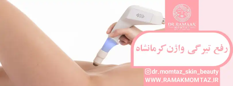 رفع تیرگی واژن کرمانشاه