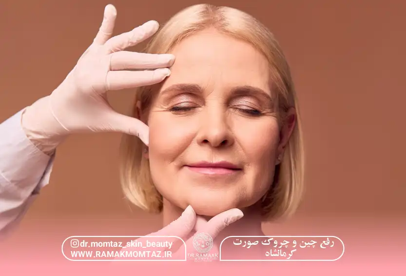رفع چین و چروک صورت کرمانشاه