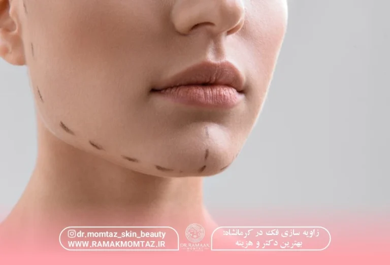 زاویه سازی فک در کرمانشاه: بهترین دکتر و هزینه (1404)