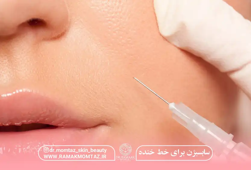 سابسیژن برای خط خنده