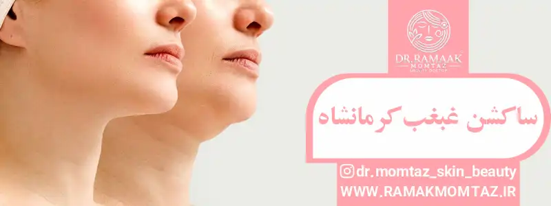 ساکشن غبغب کرمانشاه