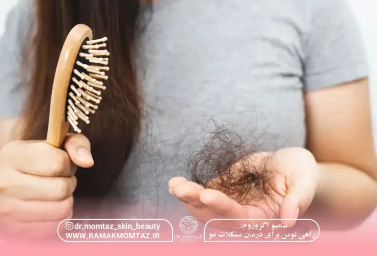 شامپو اگزوزوم: راهی نوین برای درمان مشکلات مو