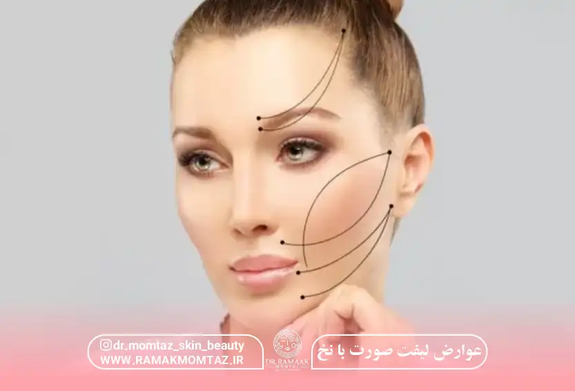عوارض لیفت صورت با نخ