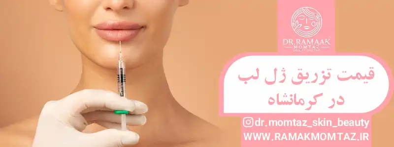 قیمت تزریق ژل لب در کرمانشاه