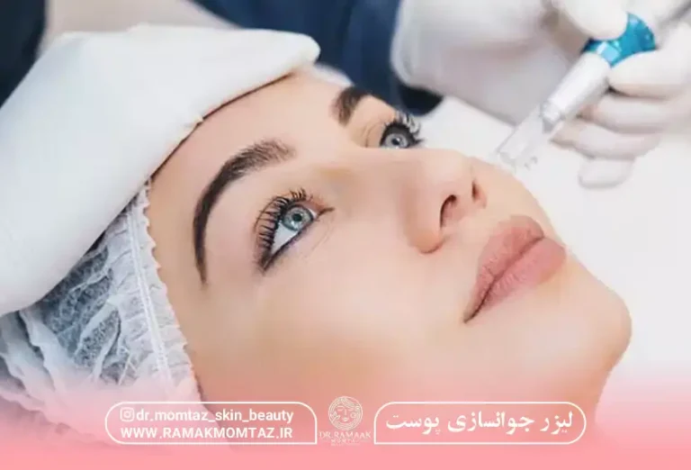 لیزر جوانسازی پوست: انواع و مزایا {1403}