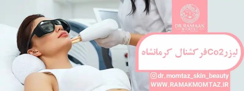 لیزر سی او 2 فرکشنال کرمانشاه