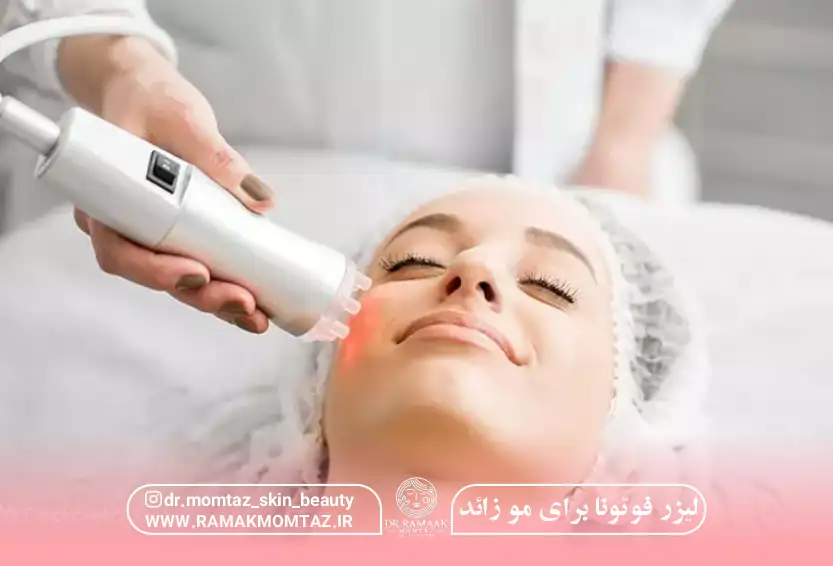 لیزر فوتونا برای مو زائد کرمانشاه