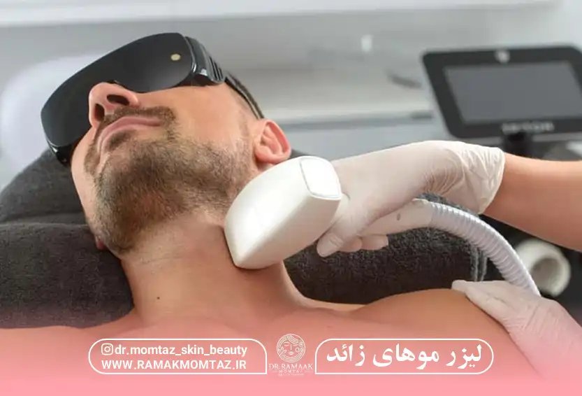 لیزر مو زائد کرمانشاه