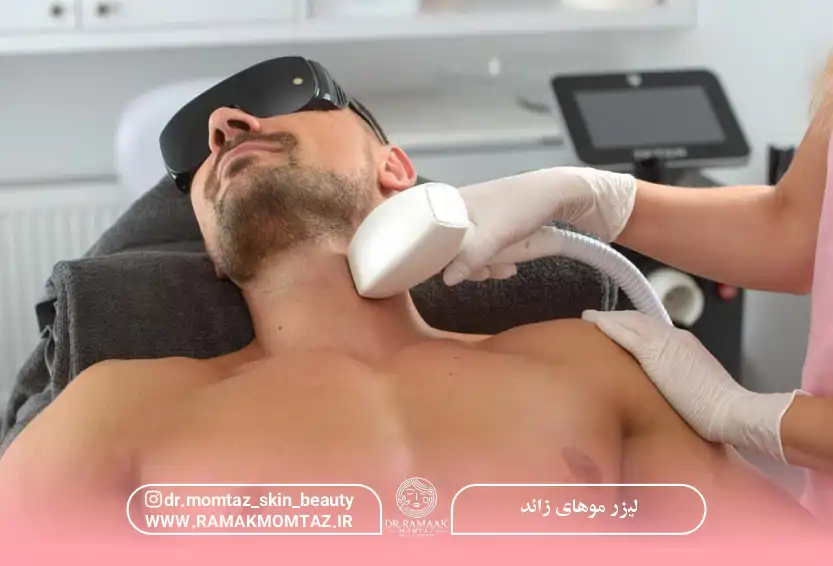 لیزر موهای زائد چند وقت یکبار
