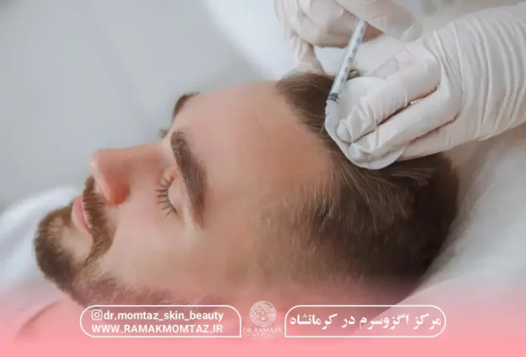 مرکز اگزوسرم در کرمانشاه