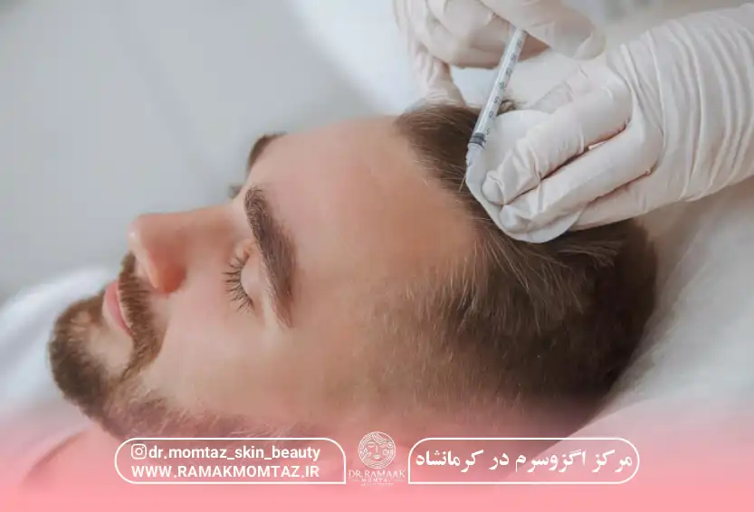 مرکز اگزوسرم در کرمانشاه