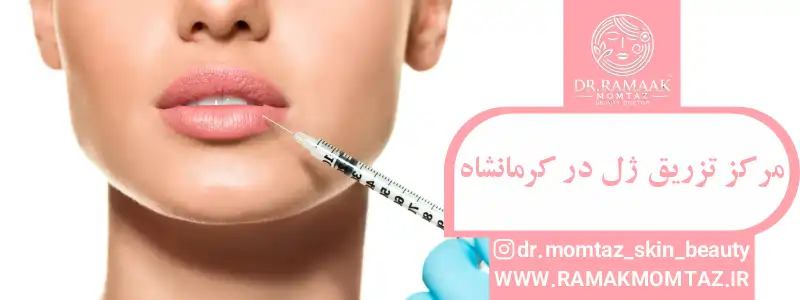 مرکز تزریق ژل در کرمانشاه