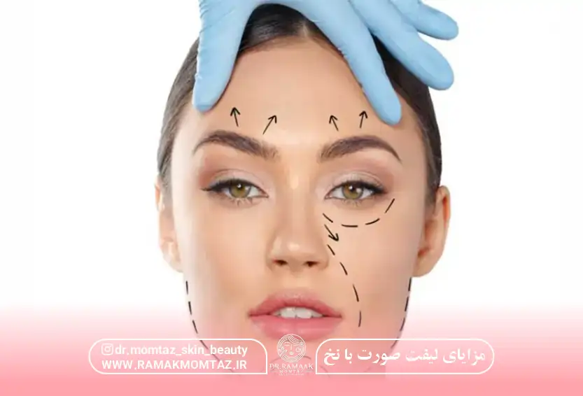 مزایای لیفت صورت با نخ