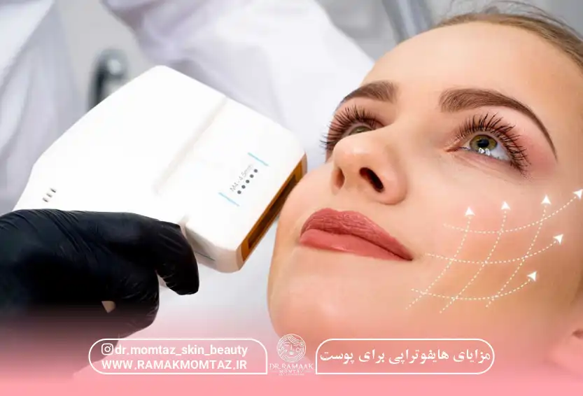 مزایای هایفوتراپی برای پوست