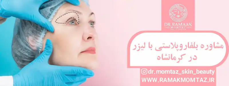 بلفاروپلاستی با لیزر کرمانشاه