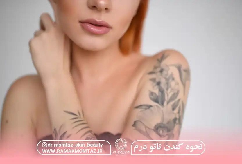 نحوه کندن تاتو درم: بهترین روشها هزینههای آن (1403) ❤