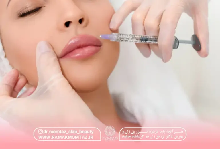 راز زیبایی ماندگار: هرآنچه باید درباره تزریق ژل و بهترین دکتر تزریق ژل در کرمانشاه بدانید