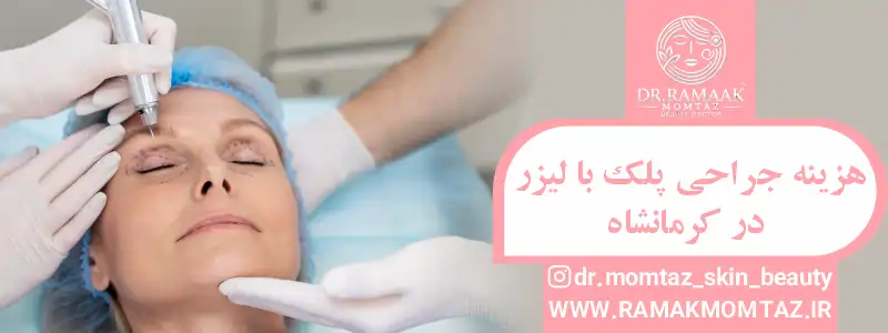 هزینه جراحی پلک با لیزر در کرمانشاه