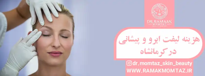 هزینه لیفت ابرو و پیشانی در کرمانشاه
