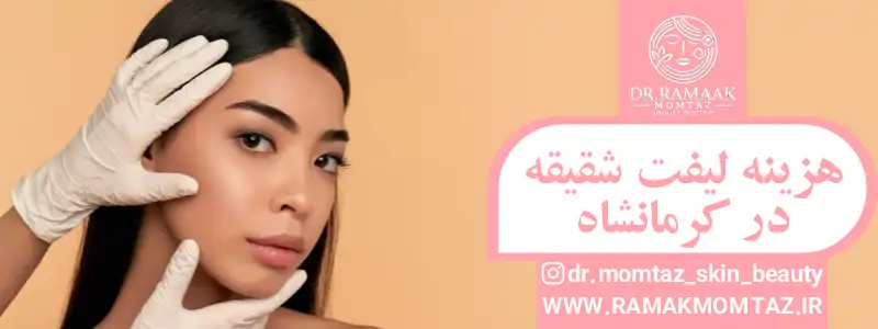 هزینه لیفت شقیقه در کرمانشاه