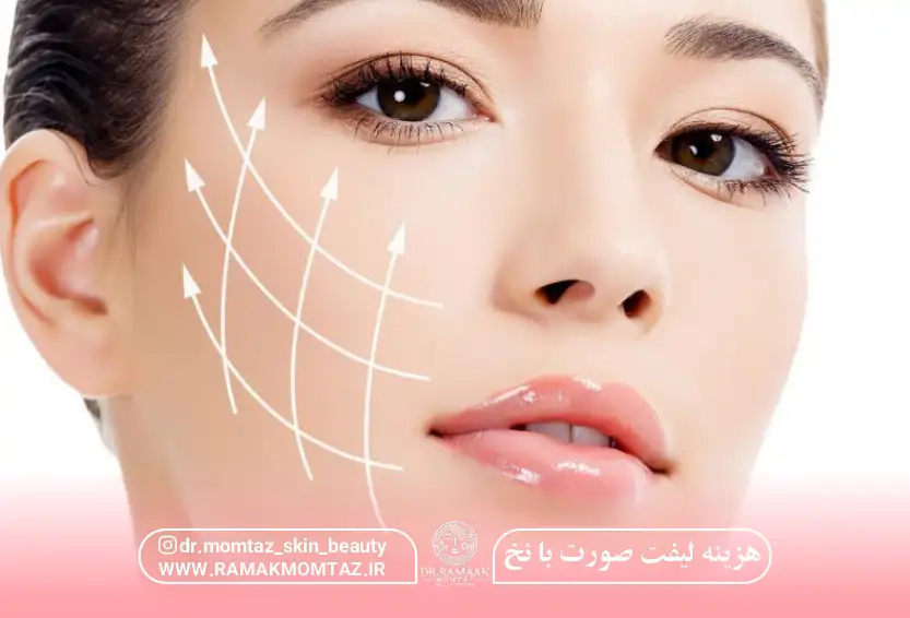 هزینه لیفت صورت با نخ