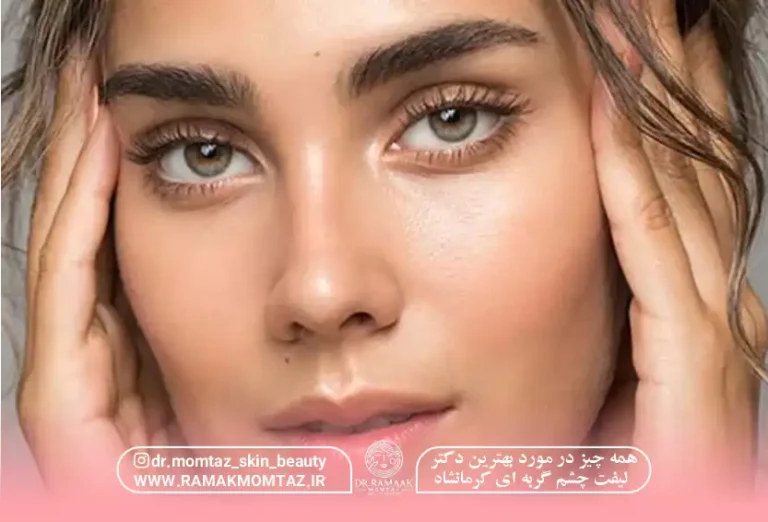 همه چیز در مورد بهترین دکتر لیفت چشم گربه ای کرمانشاه 1404