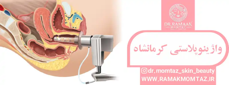واژینوپلاستی کرمانشاه
