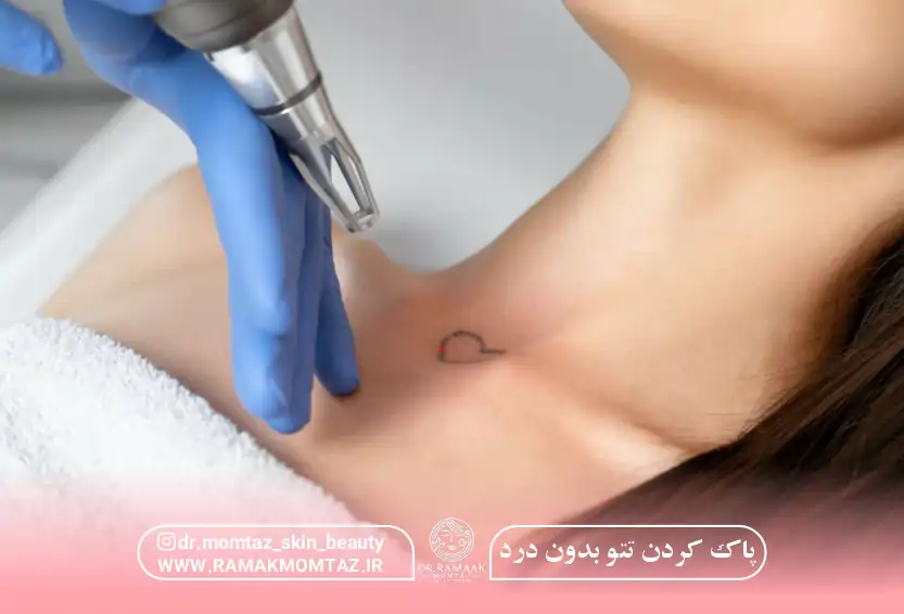 پاک کردن تتو بدون درد