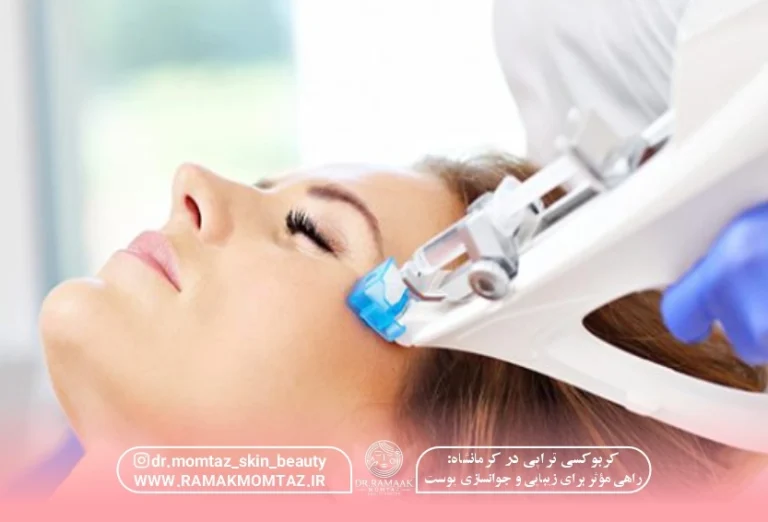 کربوکسی تراپی در کرمانشاه راهی مؤثر برای زیبایی و جوانسازی پوست